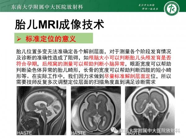 胎儿脑发育不良的监测与早期发现