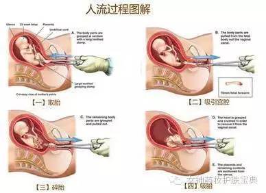 两个月做人流的伤害评估与应对